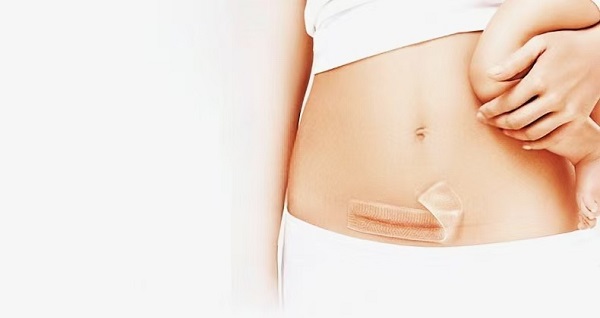 Perché i fogli spessi per cicatrici in gel di silicone sono così popolari?